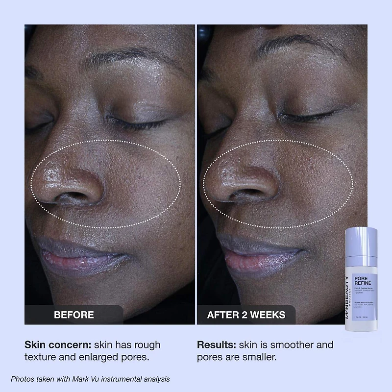 Pore Refine Pore Shrinking & Texture Smoothing Serum