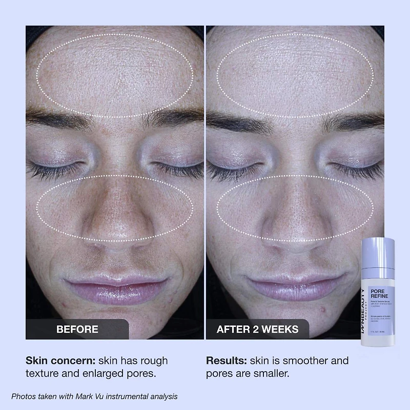 Pore Refine Pore Shrinking & Texture Smoothing Serum