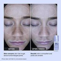 Pore Refine Pore Shrinking & Texture Smoothing Serum