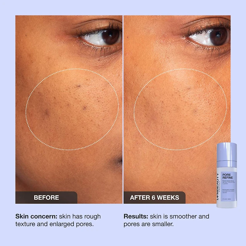 Pore Refine Pore Shrinking & Texture Smoothing Serum