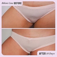 Minirondelles pour poils incarnés avec BHA et AHA