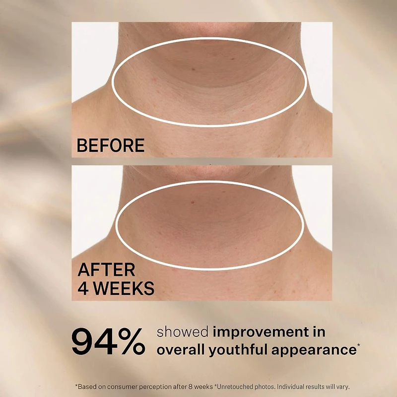 TL Advanced™ Tightening Neck Cream PLUS with Alpha-3 Peptide ™