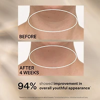 TL Advanced™  Tightening Neck Cream PLUS with Alpha-3 Peptide ™