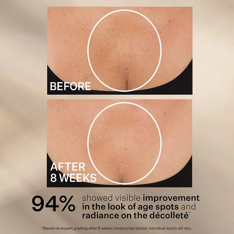TL Advanced™ Tightening Neck Cream PLUS with Alpha-3 Peptide ™
