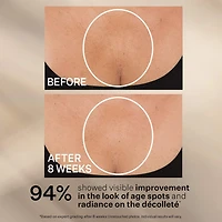TL Advanced™  Tightening Neck Cream PLUS with Alpha-3 Peptide ™