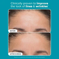 6% Mandelic Acid + 2% Lactic AHA Liquid Exfoliant for Dark Spots, Textured Skin