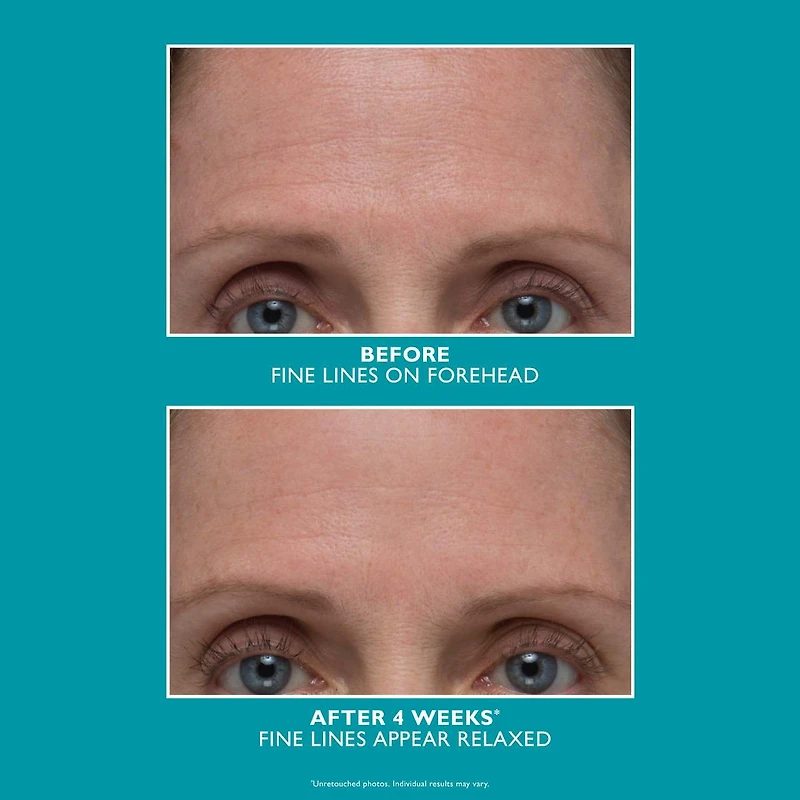 Sérum amplifié antirides et raffermissant peptide Skinjection™						