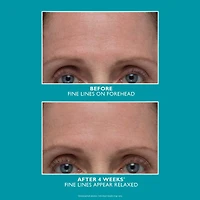 Sérum amplifié antirides et raffermissant peptide Skinjection™						