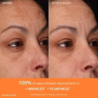 Concentrated Ginseng Rejuvenating Cream for Anti-Aging