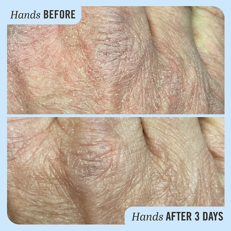 Ultra Repair® Cream Intense Hydration – Face and Body Moisturizer for Skin Repair