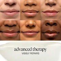 Sugar Advanced Therapy Treatment Lip Balm