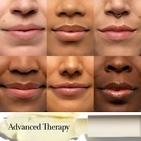 Soin pour les lèvres Sugar Advanced Therapy