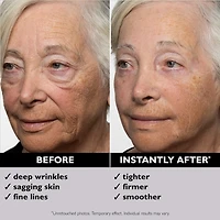Raffermissant pour le visage temporaire Instant FIRMxMD