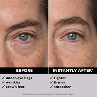 Soin liftant des yeux temporaire Instant FIRMx® Eye