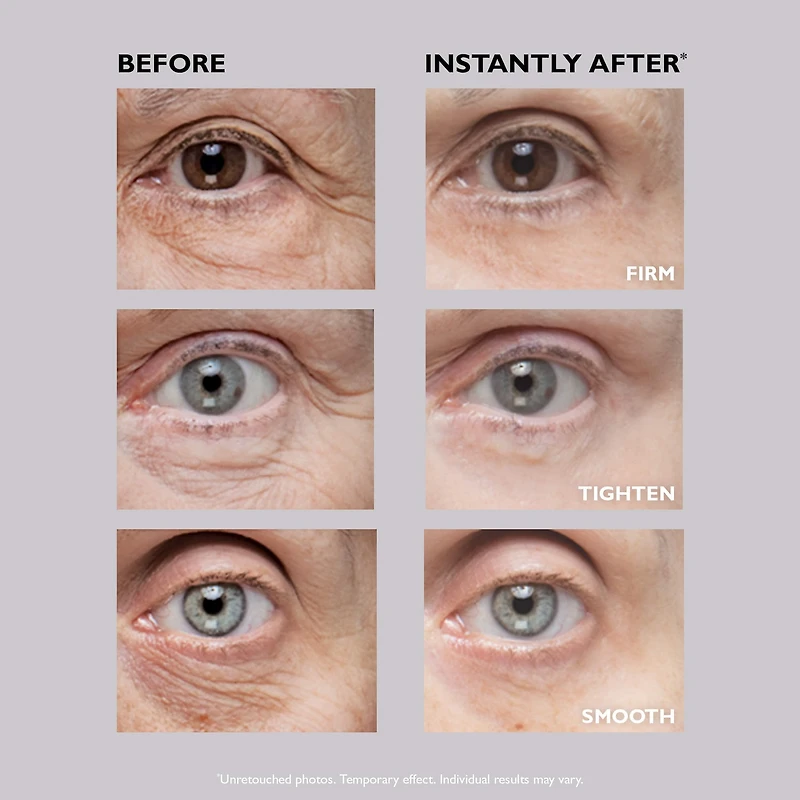 Soin liftant des yeux temporaire Instant FIRMx® Eye