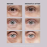 Soin liftant des yeux temporaire Instant FIRMx® Eye