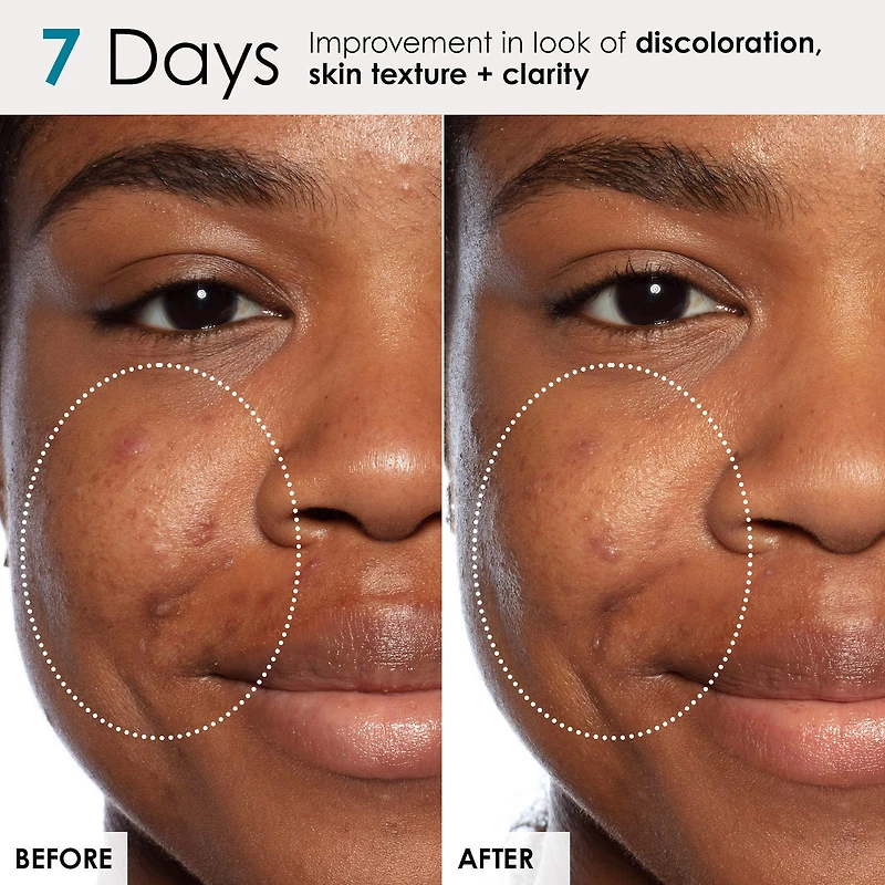 Good Genes All-In-One Lactic Acid Serum For Dark Spots And Uneven Texture