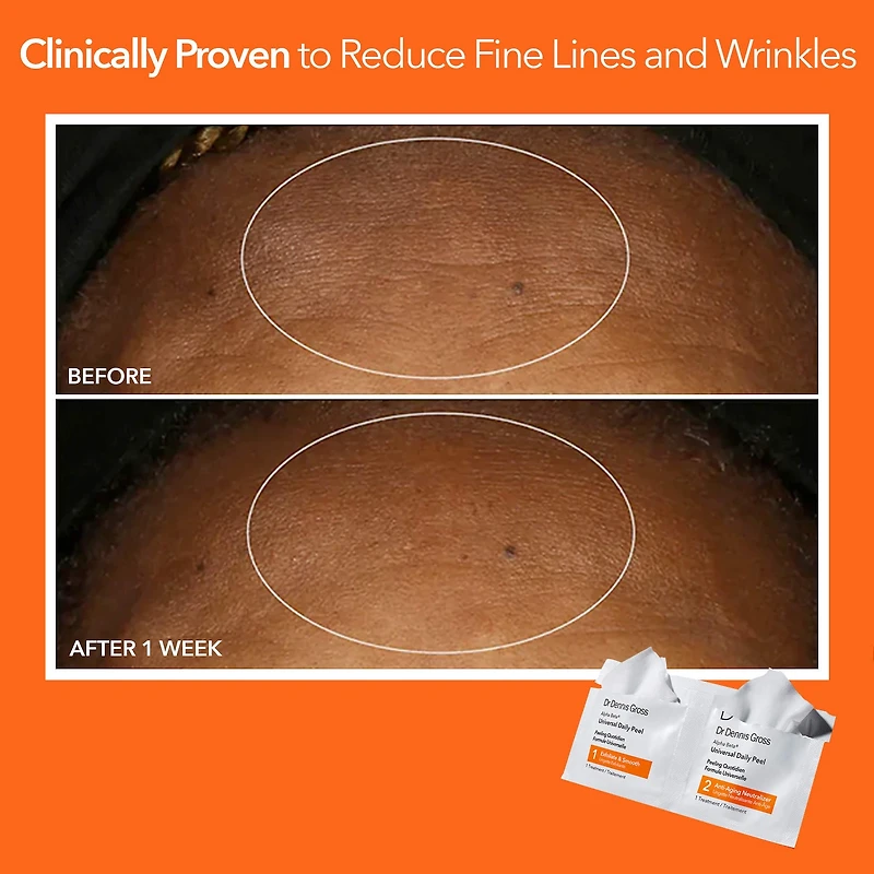 Alpha Beta® Universal Daily Peel Pads