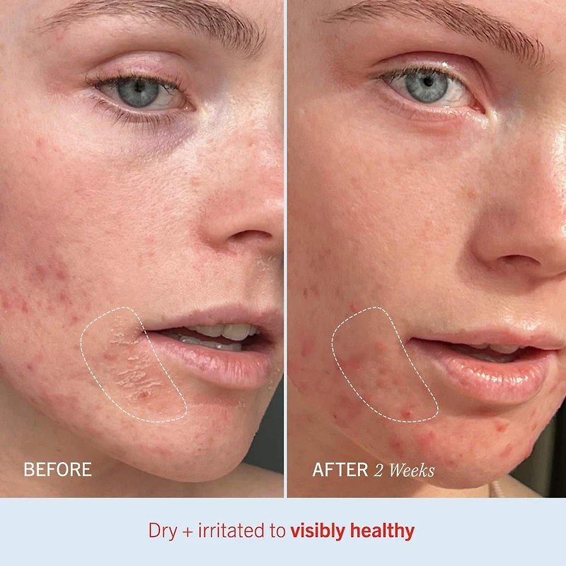 Crème hydratante intense Ultra Repair®, hydratant pour le visage et corps la réparation de peau