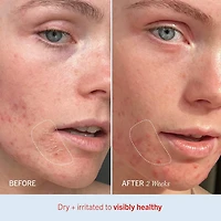 Crème hydratante intense Ultra Repair®, hydratant pour le visage et corps la réparation de peau