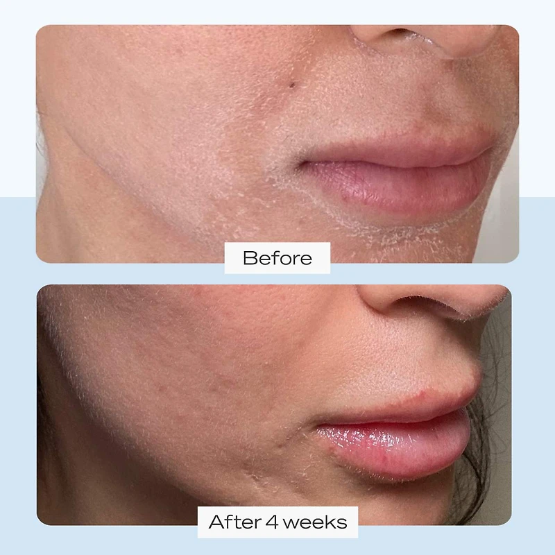 Crème hydratante intense Ultra Repair®, hydratant pour le visage et corps la réparation de peau