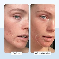 Crème hydratante intense Ultra Repair®, hydratant pour le visage et corps la réparation de peau