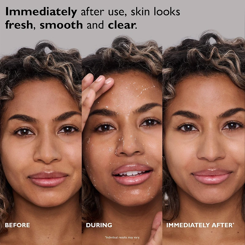 FIRMx® Exfoliating Peeling Gel for Dullness, Pores & Uneven Texture