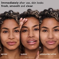 FIRMx® Exfoliating Peeling Gel for Dullness, Pores & Uneven Texture