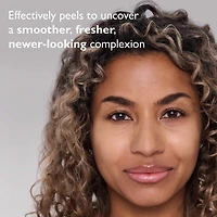 FIRMx® Exfoliating Peeling Gel for Dullness, Pores & Uneven Texture