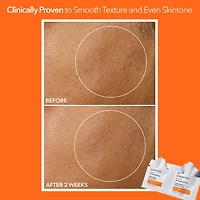 Alpha Beta® Universal Daily Peel Pads