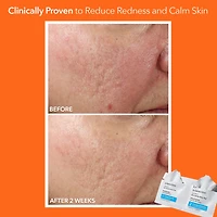 Tampons exfoliants quotidiens ultradoux pour peau sensible Alpha Beta®