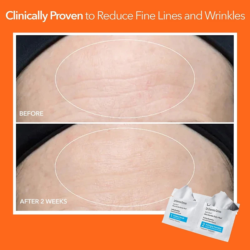 Tampons exfoliants quotidiens ultradoux pour peau sensible Alpha Beta®