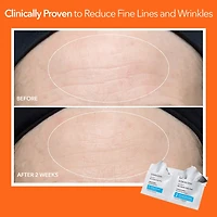 Tampons exfoliants quotidiens ultradoux pour peau sensible Alpha Beta®