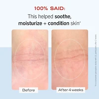 Crème hydratante intense Ultra Repair®, hydratant pour le visage et corps la réparation de peau