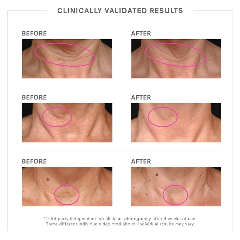 STEM CELLULAR™ Lifting Neck Cream