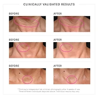 STEM CELLULAR™ Lifting Neck Cream