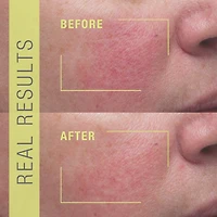 Sérum stimulant antirides STEM CELLULAR