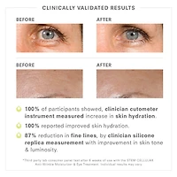 STEM CELLULAR™ Anti-Wrinkle Solutions