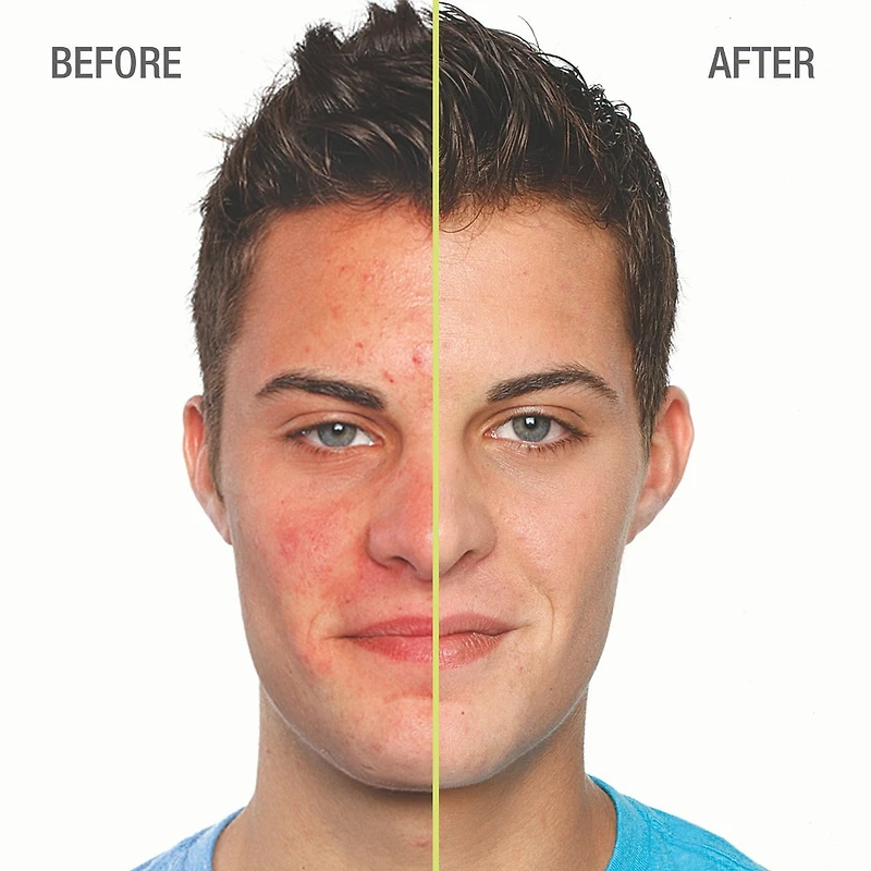 Sérum anti-imperfections Blemish Clearing™ 