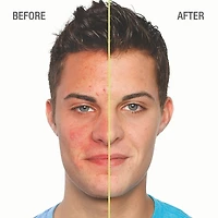 Sérum anti-imperfections Blemish Clearing™ 