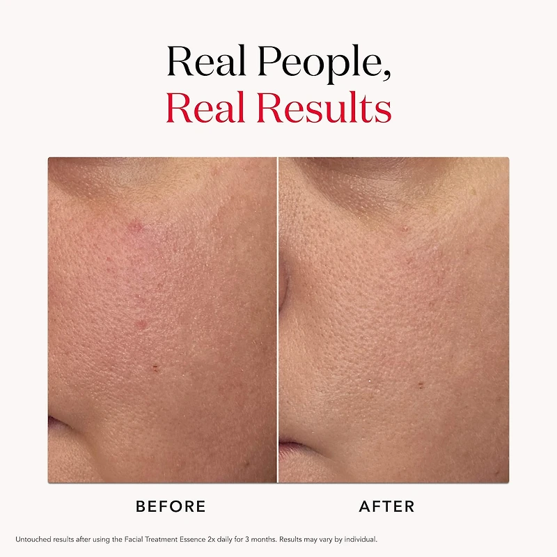 Aging Skin Facial Treatment Essence with Antioxidants