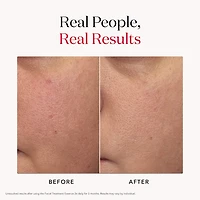 Aging Skin Facial Treatment Essence with Antioxidants