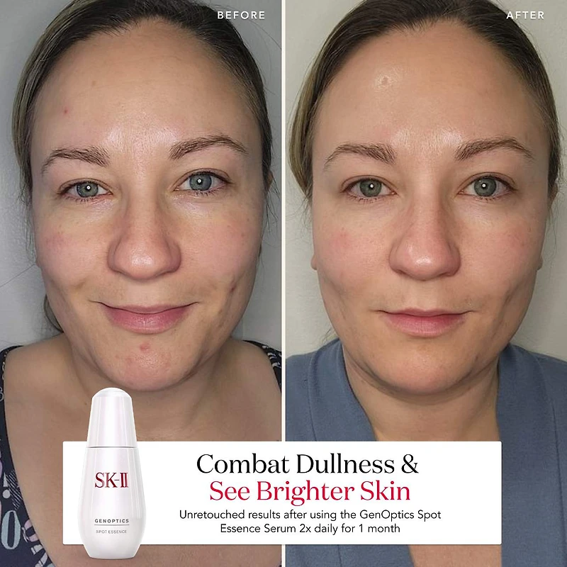 GenOptics Spot Essence Serum