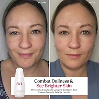 GenOptics Spot Essence Serum