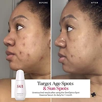 GenOptics Spot Essence Serum