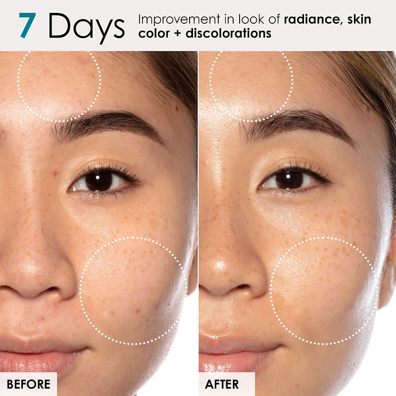 Good Genes All-In-One Lactic Acid Serum For Dark Spots And Uneven Texture