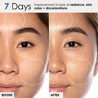 Good Genes All-In-One Lactic Acid Serum For Dark Spots And Uneven Texture