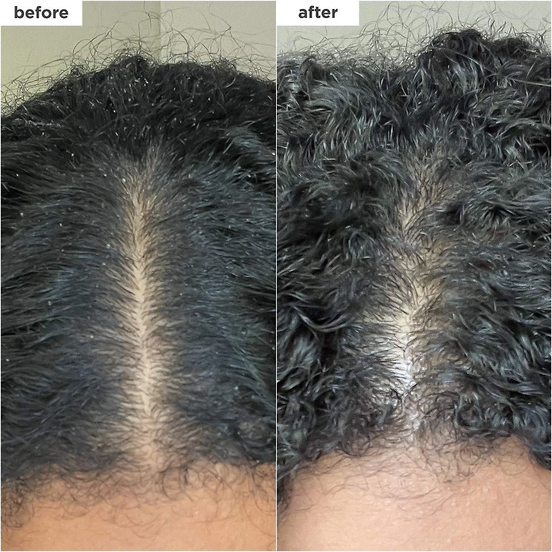 Shampoing micro-exfoliant charbon et huile de coco pour cuir chevelu Scalp Revival™