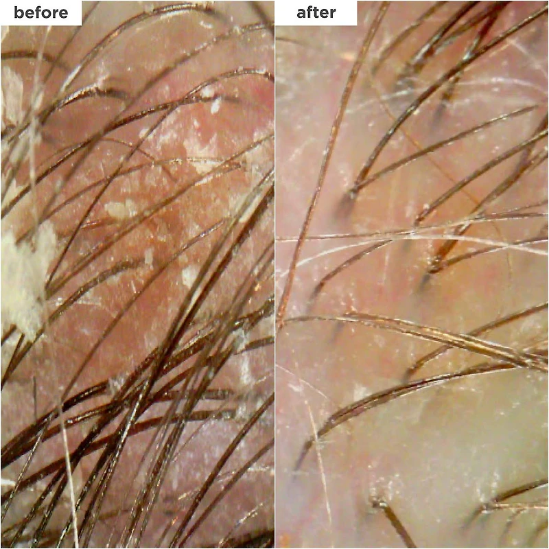 Shampoing micro-exfoliant charbon et huile de coco pour cuir chevelu Scalp Revival™