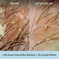 Scalp Revival Charcoal + Coconut Oil Micro-exfoliating Scrub Shampoo